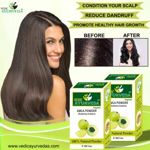 Amla Powder: Benefits, Uses, and How to Use It for Hair and Skin 1 Amla Powder