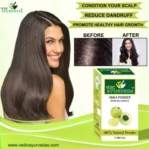 Haircare Benefits of Amla Powder: 7 Advantages of Using It 1 Amla Powder