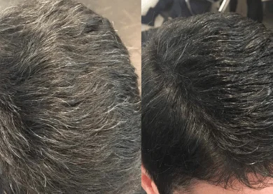 gray hair to black hair