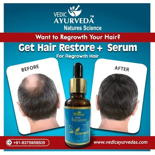 Hair Growth Serum: Unlock Your Hair's Full Potential Naturally 1 Hair Growth Serum for stronger, healthier-looking hair